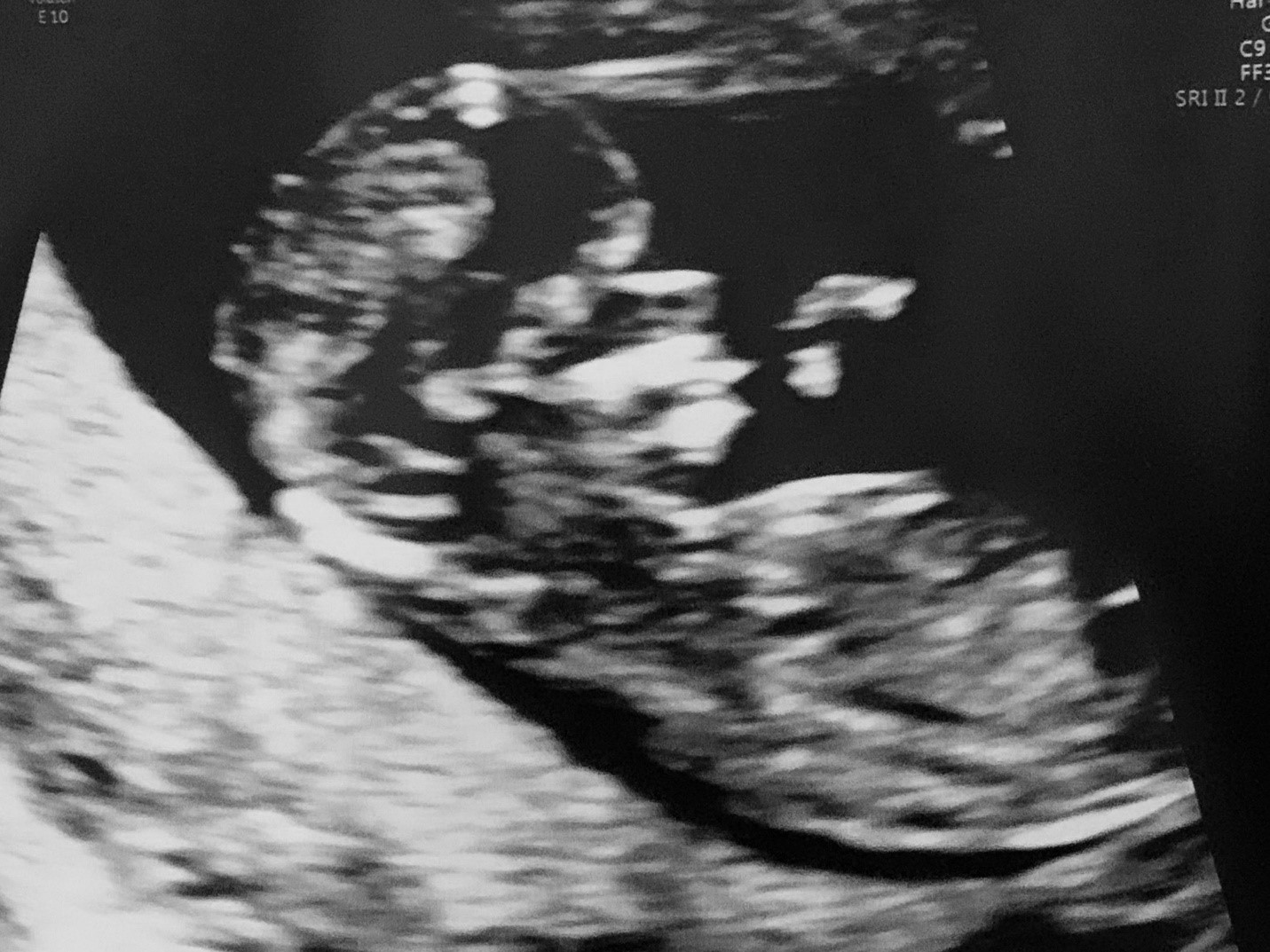 Prenatal Visits